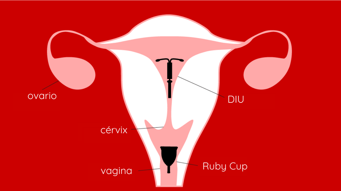 Guía para usar una copa menstrual con un DIU