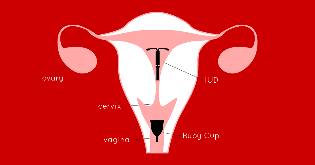 Blog posts Can You Use a Menstrual Cup With An IUD?