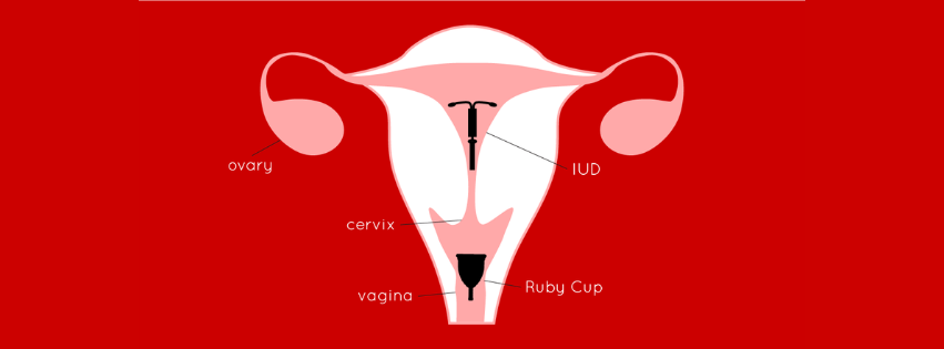 IUD and Menstrual Cup Ruby Cup Graphic 