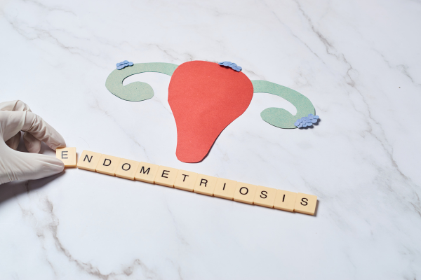 Endometriosis: All You Need To Know (Medically Reviewed)